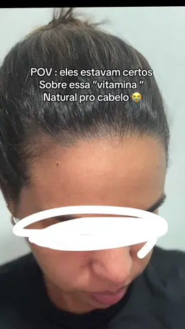 Não acredito que transformei meu cabelo tomando 20 gotinhas desse óleo mágico por dia #calvicie #quedadecabelo #natural #suplementos 