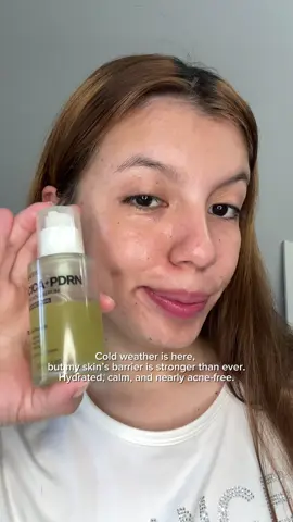 ✨ Clear Acne in Just 7 Days? ✨ I tested the #NACIFIC CICA PDRN Calming Serum for a full week — even with the cold weather drying everything out, my skin stayed hydrated, calm, and breakout-free 💧🌿 Packed with Centella, PDRN, and Tea Tree, it truly helped repair my barrier and fade acne fast. Would you try this 7-day challenge? #CICAPDRN #skintransformation #acneskincare #koreanskincare  @NACIFIC US @네시픽 Nacific Official 