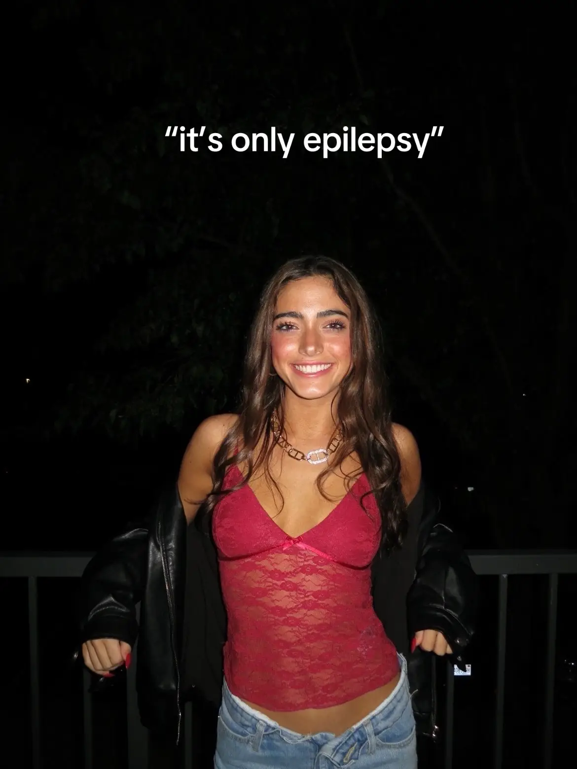 #epilepsyawareness #seizures 