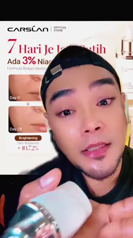 Replying to @Ammm korang try la consistent COMPOM repeat lagi OMG .. #caslan #skincare #beauty #viral #thekingoftips 
