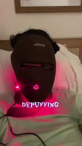 The swelling continues! Trying my hardest. #microinfluencer #beautyinfluencer #antiaging #beautydevice #postprocedurecare @JOVS 