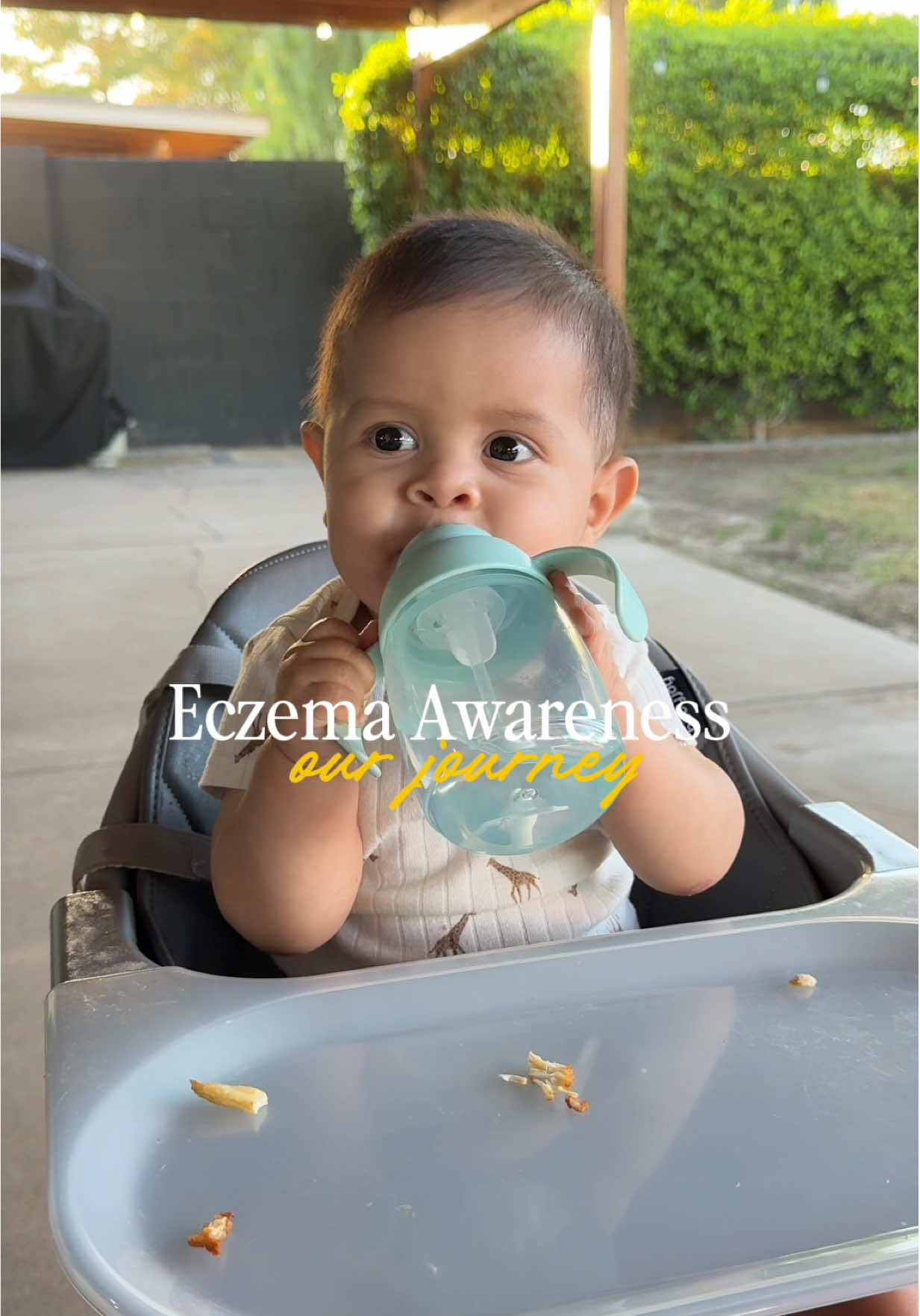 ***TRIGGER WARNING*** ⚠️ ⚠️  my little warrior, I’ll make a video of everything I’ve used, prescribed and non prescribed.  #eczema #eczemaawareness #MomsofTikTok #parents #eczemahealing 