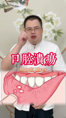 口腔溃疡 mouth ulcer #口腔溃疡 #mouth #mouthulcer #中医 #fyp #tcm #穴位 