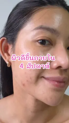 ผิวดีขึ้นภายใน 4 สัปดาห์ @kana_health_thailand  #Glutakana #Kanahealth