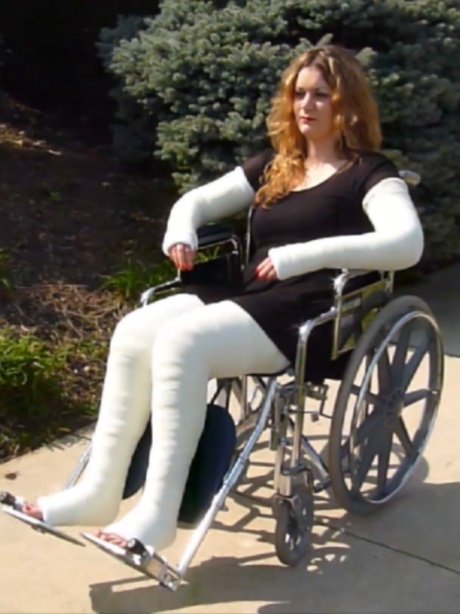 Amazing casts 🤯🥰 #dllc #dlac #wheelchair 