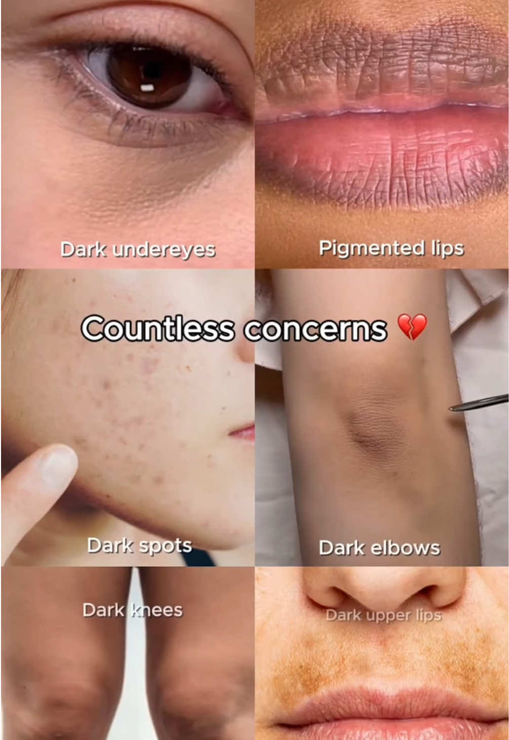 @KSECRET GLOBAL  . . . . . . #ksecretglowchallenge #ksecret #seoul1988 #hyperpigmentation #darkspots 