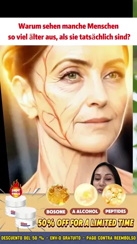 Lw Arrugas, adiós: Descubre el tratamiento que realmente funciona en días#face #cream #wrinkles #antiedad #fyp 