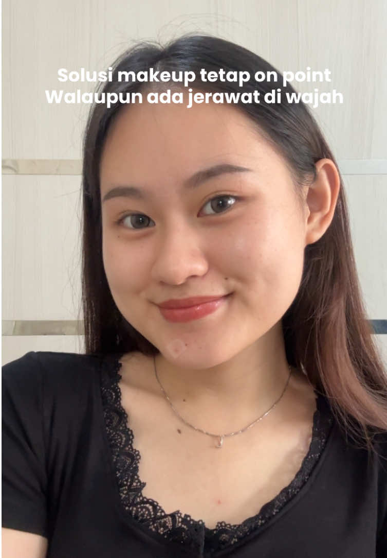 solusi andalan klo muka lg ngamuk 🥹🫶🏻 @Hansaplast Indonesia #hansaplast #secondskin #healfasterlikesecondskin #tenangbawahansaplast #acnepatch 