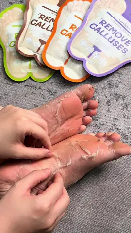 Jangan muka aja yang di rawat!!  Kaki juga dong 🫰🏻✨ Aku pake Foot Peel Maks dari @Lanbena.Smooth  dalam 3-7 hari kaki auto halu dan glowing 🩷 Buruan cek di keranjang kuning kuu 🫶🏻 #footmask #footpeelingmask #maskerkakilanbena #lanbenafootmask #skincareroutine 