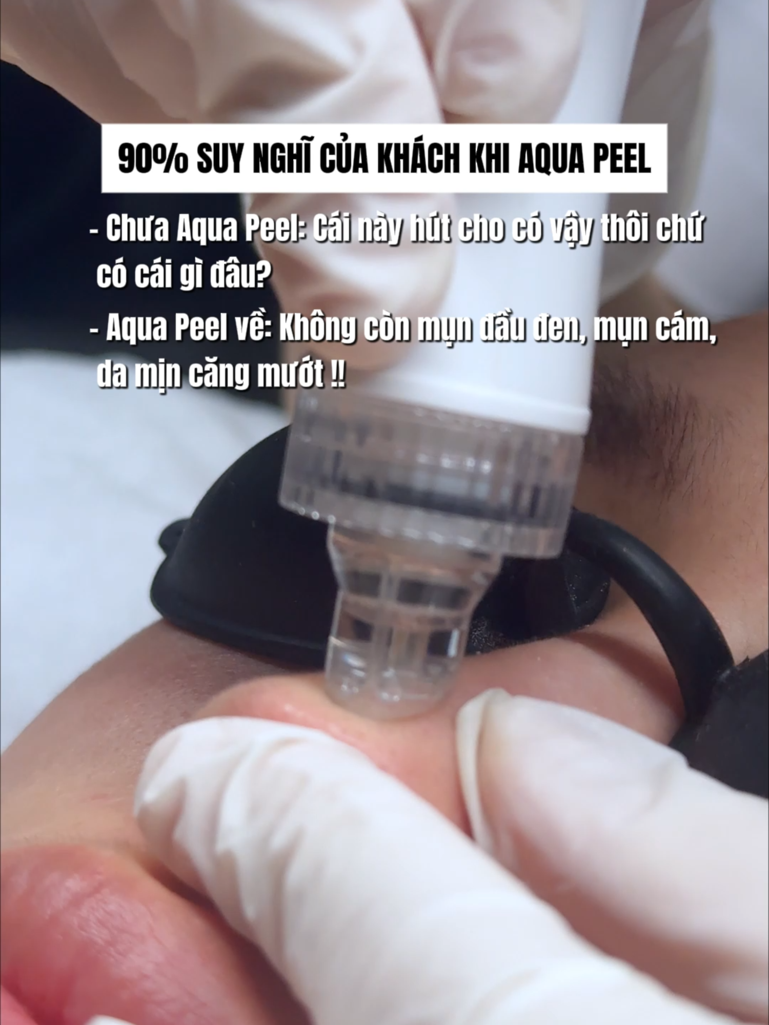 90% suy nghĩ của khách khi Aqua Peel #mialalanhatrang #spanhatrang #aquapeel #sachsau #xh