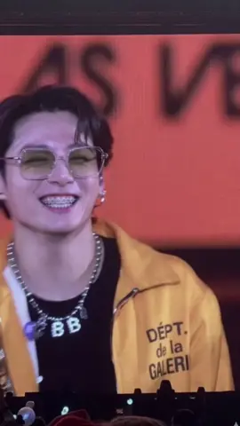 ฟันเหล็กเด็กพี่แท #jungkook #อย่าปิดการมองเห็น #fyp #ตระกูลคิงโพดํา #kookv 