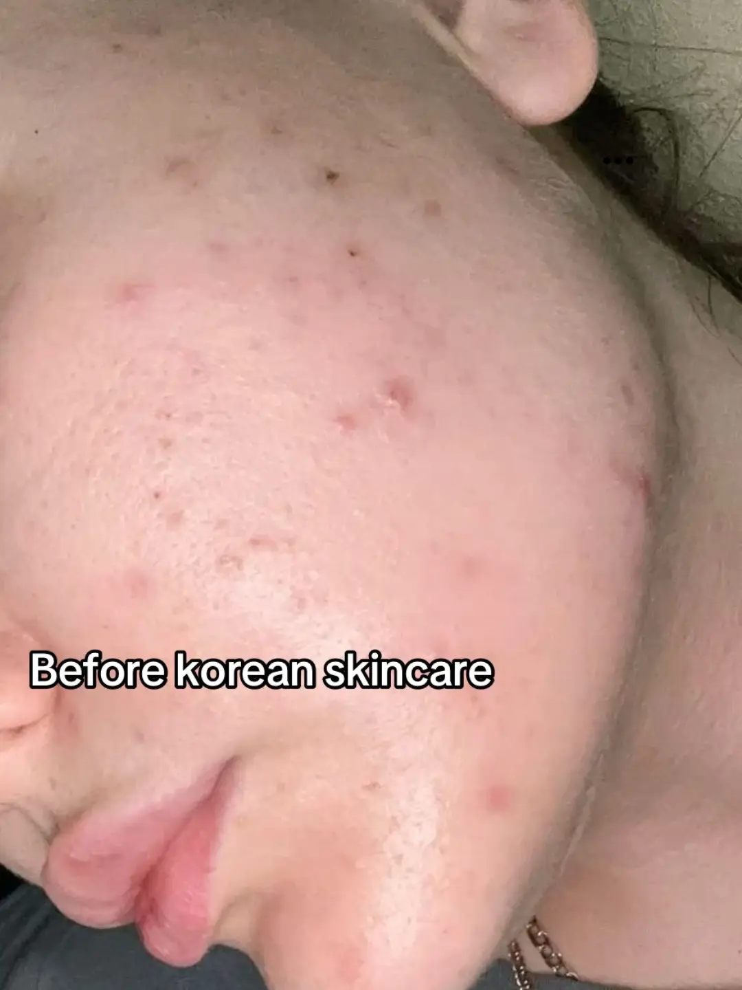 #healthyskincare#glowingskin #hydrating #trending 
