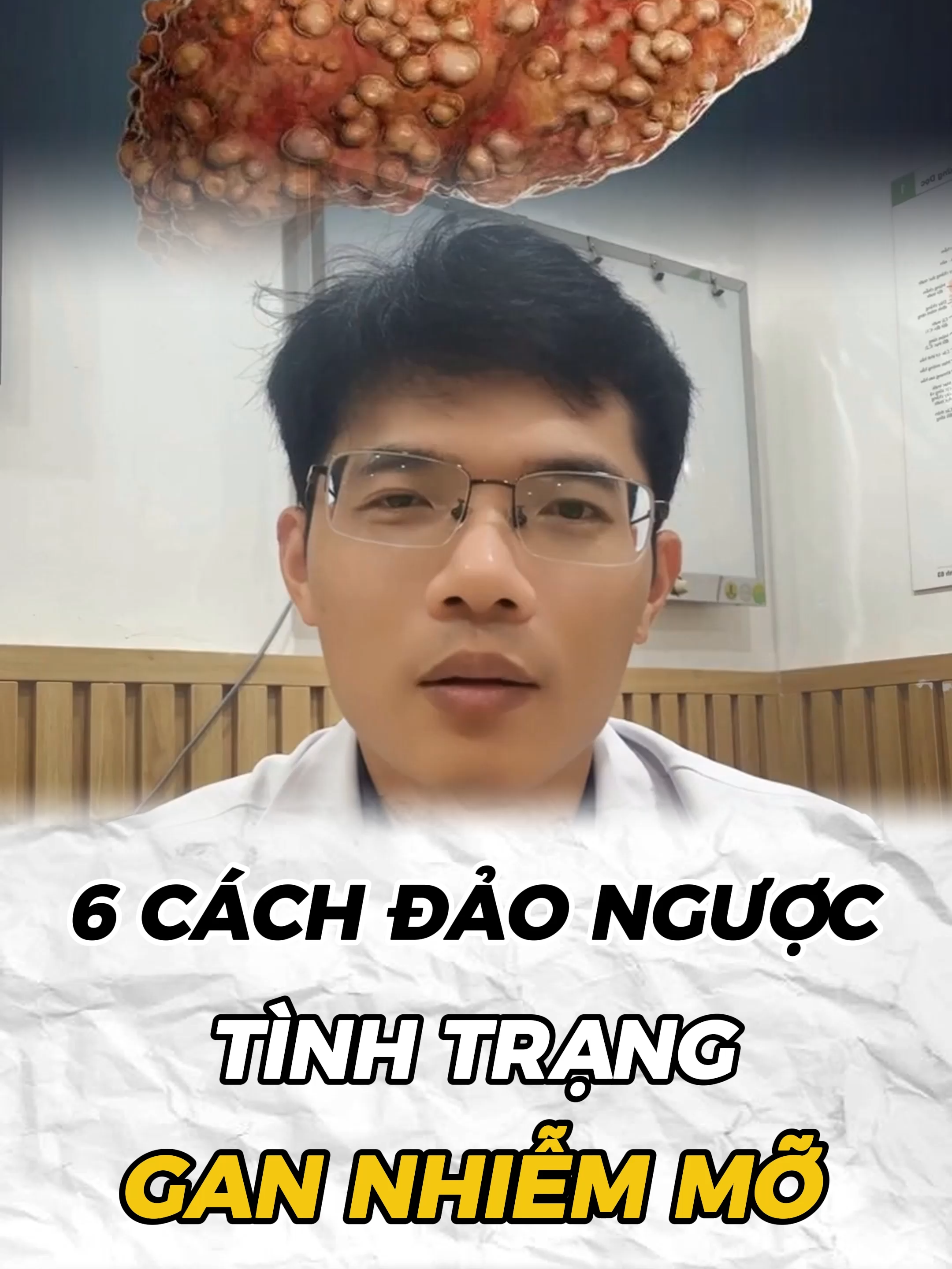 6 cách đảo ngược tình trạng gan nhiễm mỡ #bacsidung #bacsidungungbuou #gannhiemmo