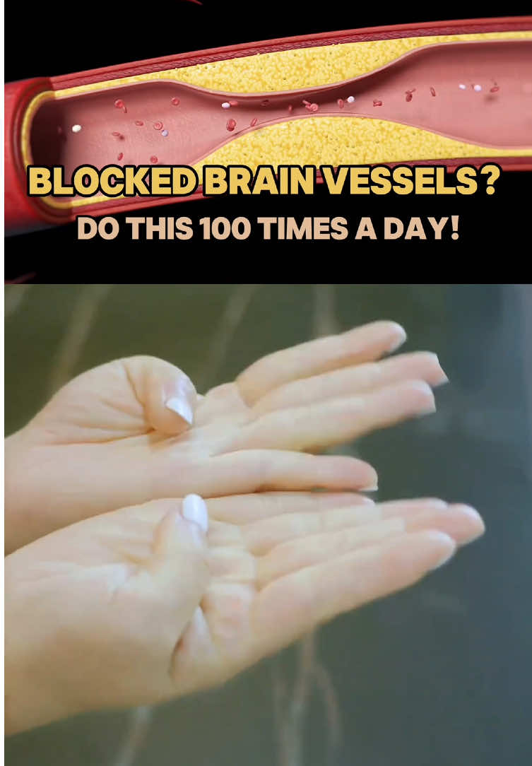 Blocked brain vessels? Do this 100 times a day 💯#fingerexercise #healthtips #wellness #acupoint #fyp #foryou 