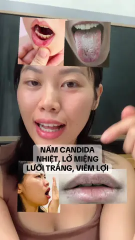 Trả lời @ngô thị trang nấm candida ở khoang miệng làm mình rất khó chịu và tự ti #namcandida #viemdacodia #namluoi #thaidoccothe 