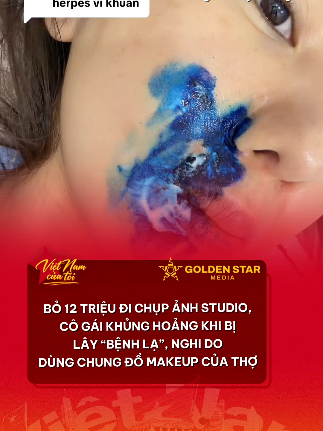 Bỏ 12 triệu đi chụp ảnh studio, cô gái khủng hoảng khi bị lây ‘bệnh lạ’, nghi do dùng chung đồ make up của thợ #vnct #vietnamcuatoi #tiktokviral #tiktoknews #viral