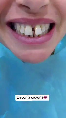 #Zirconia #tiktokviral #Plzviral #fypシ #viral 