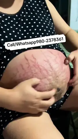 #foryoupage #musergeneretion #viralvideo #scar #scar 