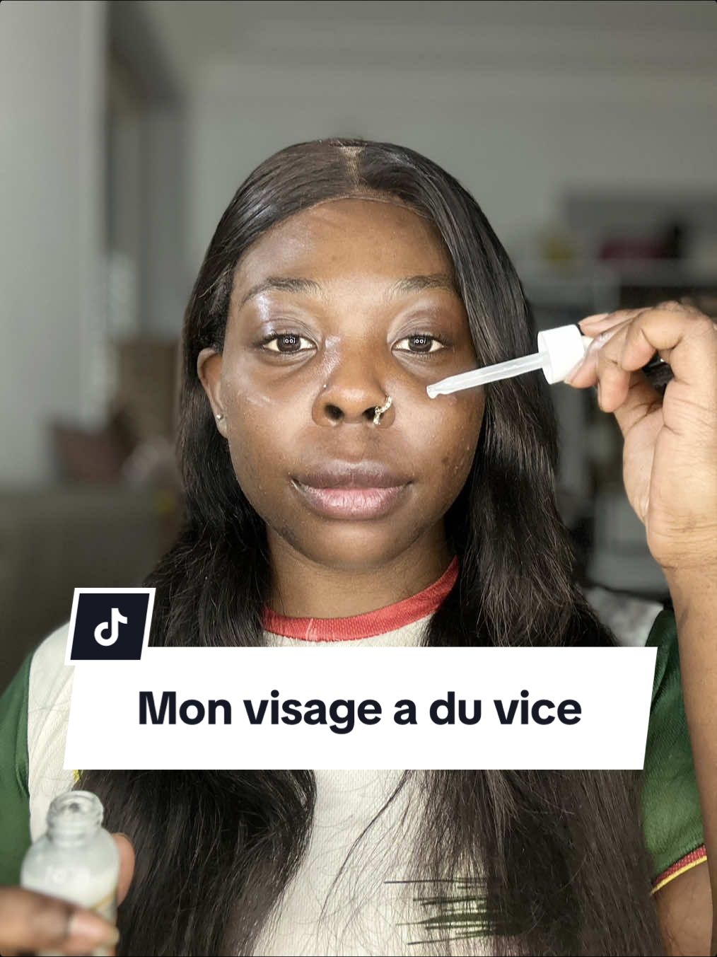 Réponse à @Ruth Natacha 🇨🇲 donc non ma belle j’ai jamais dit que c’était un exemple malheureusement c’est une malédiction 😒