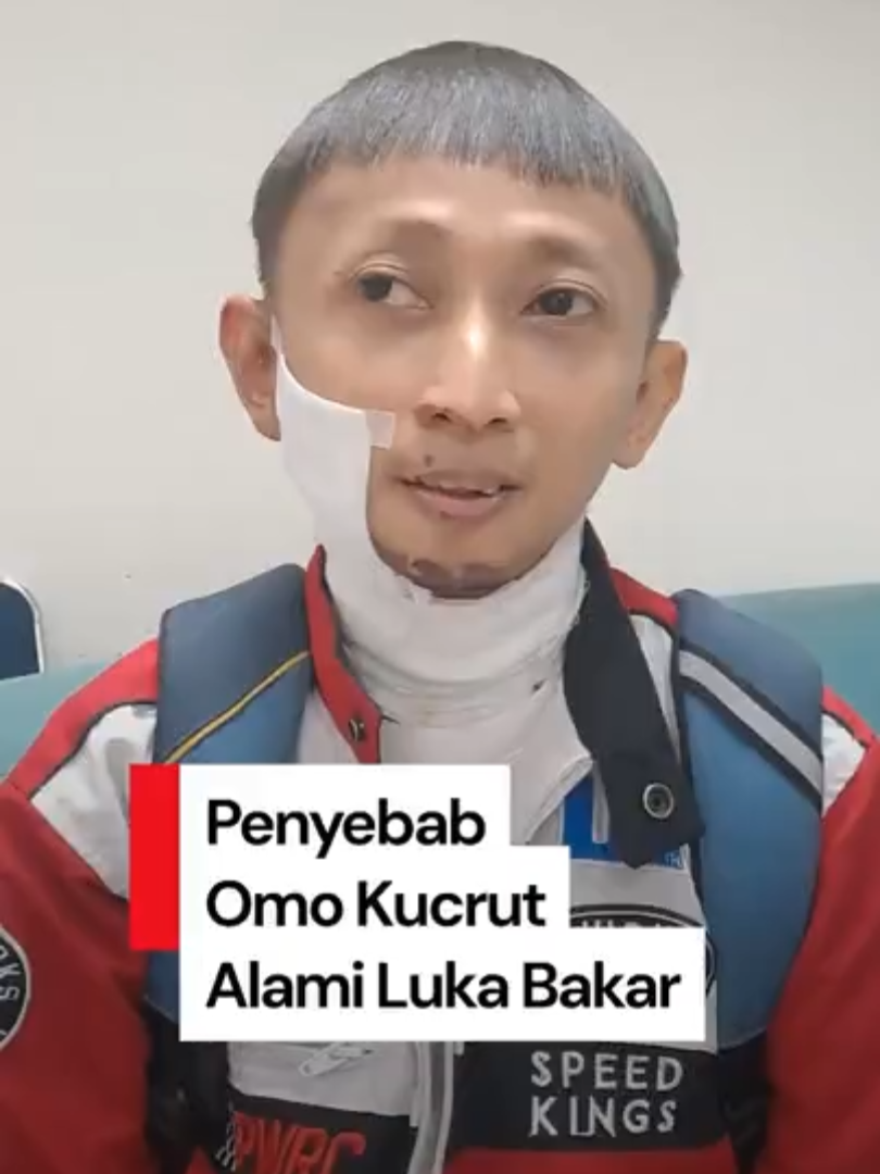 DJ Omo Kucrut alami insiden mengerikan saat manggung di sebuah klub di Balikpapan. Lewat unggahan di Instagram-nya, tampak bagian wajah bagian kanan dan lehenya mengalami luka bakar. 