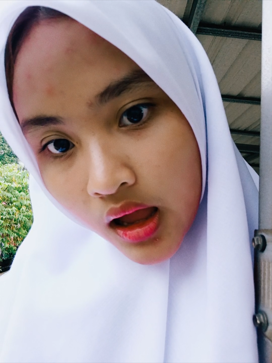 miss my old skin..  #clearskin #fyp #epyepe #closecomedo #acnefighter 