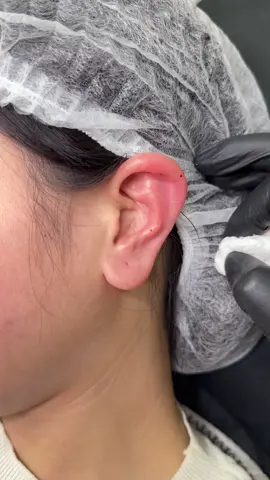 Tai tài lộc khum ạ #filler #haiphong #moixinhhaiphong #xuhuongtiktok #xuhuong 