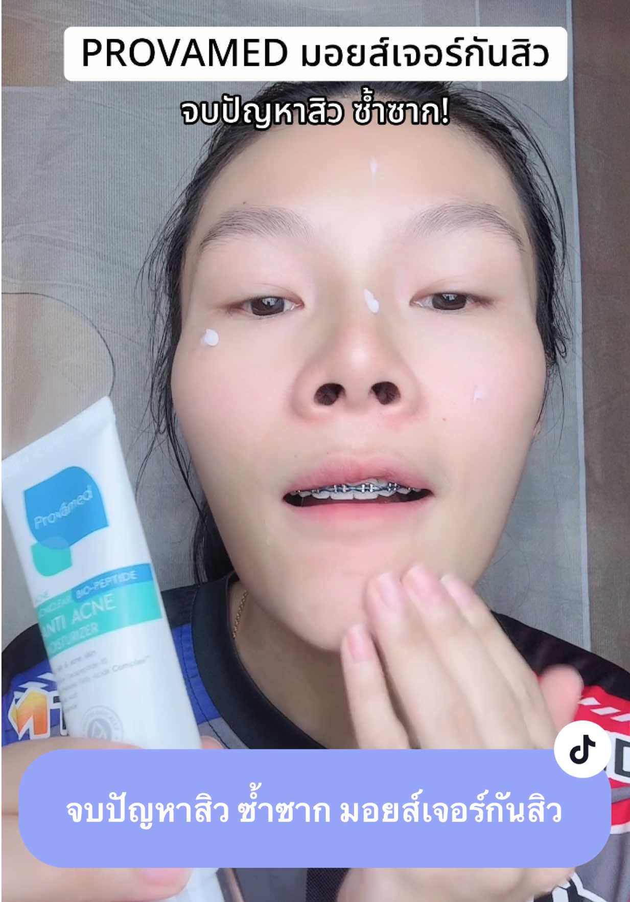 #มอยส์เจอร์กันสิว #มอยส์เจอร์โปรวาเมด #โปรวาเมด #มอยส์โปรวาเมด #มอยส์เจอร์ไรเซอร์ 
