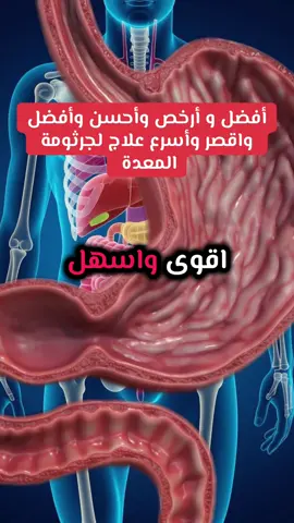أفضل و أحسن و أسهل علاج لجرثومة المعدة   #جرثومة_المعدة #علاج_طبيعي #infoandfacts #فوريو #fouryourpage 