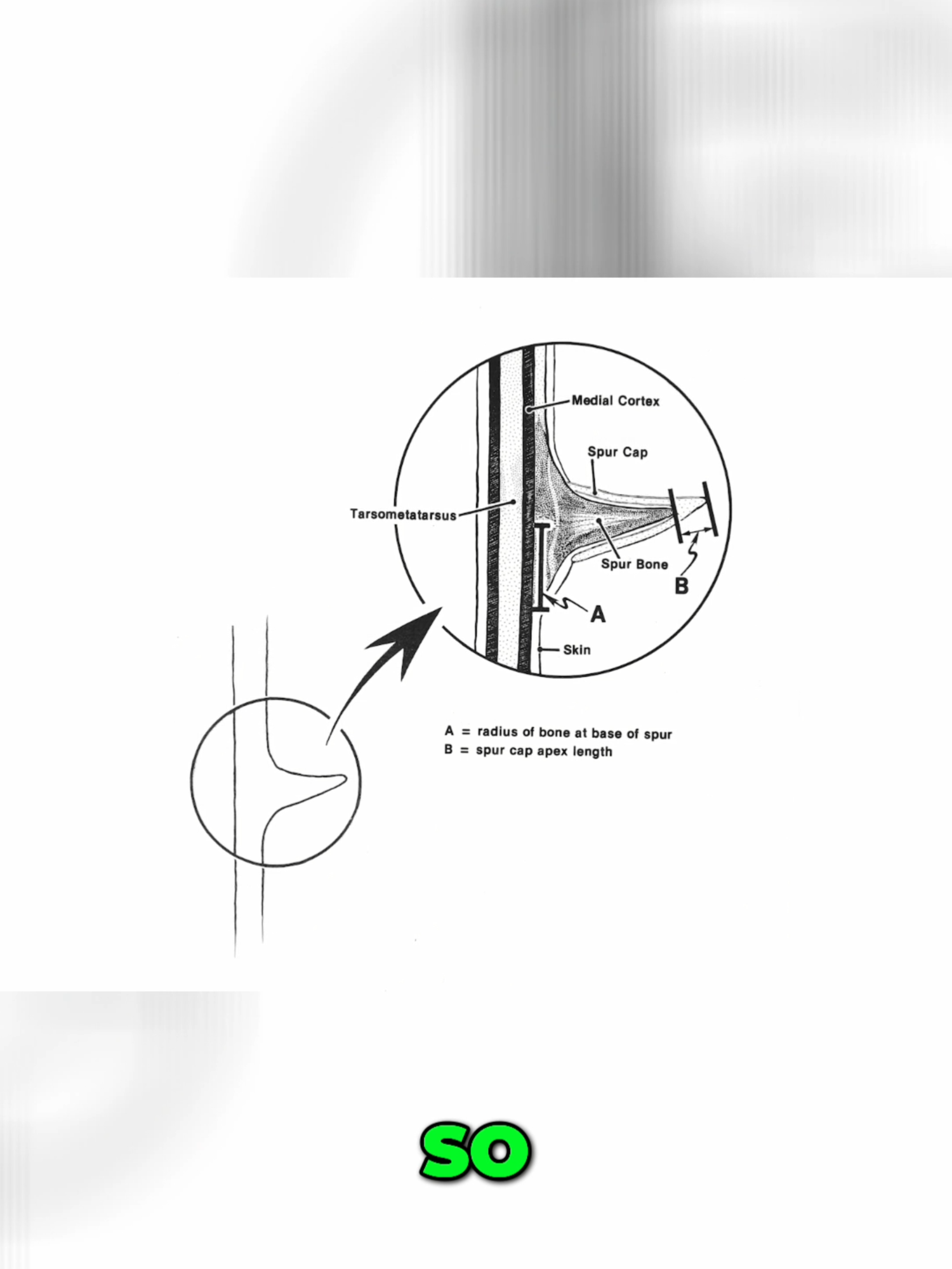 X-Ray vs. Spur Measurement: best way to age a turkey #NWTF #turkeys #turkey #hunting # wildlife #FYP #foryourpage #education