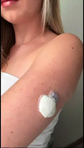 Medtronic Guardian Diabesties... we heard you! 💕💪 Here at Type One Style, we prioritise making our products the best they can be, helping you keep your CGM safe, secure, and stress-free! 🌈✨ Our Medtronic Guardian patches now come with two handy tabs so you can secure your device even more 🔒💖 ...and keep it looking neat and tidy. Because let’s be real... no one wants a creased or messy patch! 😉🎀 Tap the link in our bio to shop 350+ designs now! And get 10% off on our app with code APP10 💅 Video by @InsulinoDependente #t1dlookslikeme #medtronicguardian #medtronic #guardianenlite4 #cgm #diabadass #type1strong #type1warrior