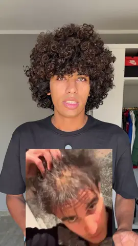 حل للصلع الوراثي بالزيوت الطبيعيه ♥️ #baloza_curly #baloza #hairtok #tiktoksalon #haircare @Oils Magic _سحر الزيوت 