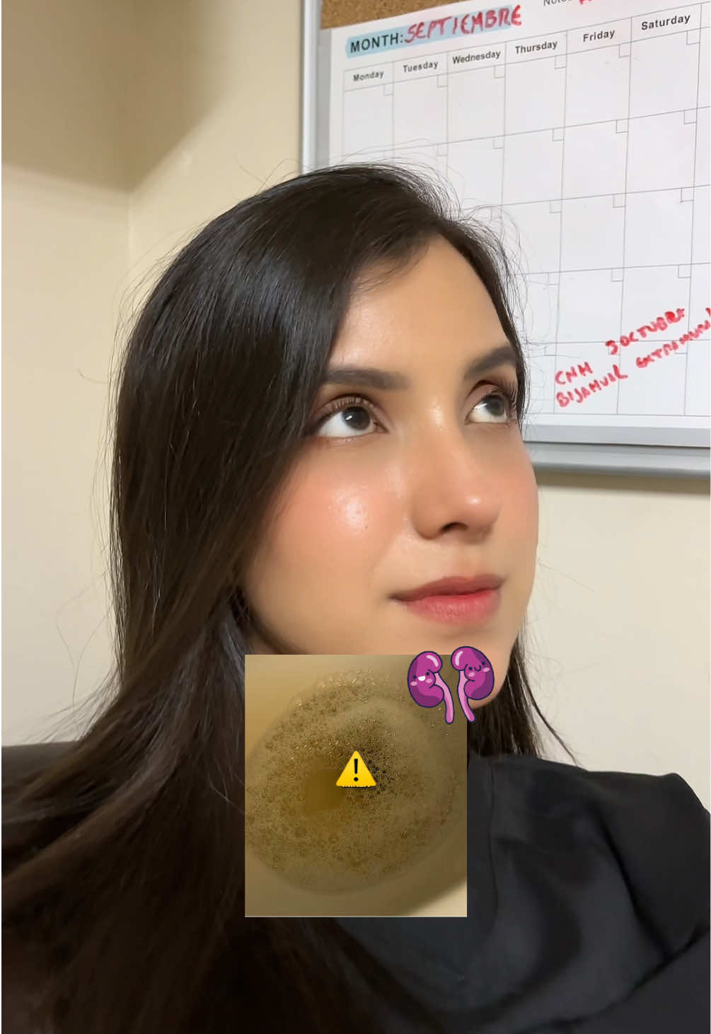 Puede ser que ya necesites hacerte diálisis! Hazte unos exámenes porfa:( #insuficienciarenal #riñones #salud 