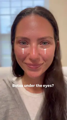 Did you know Botox can be used to treat the skin under the eyes? For patients who are deemed candidates, this can be a great way to create a more well rested appearance.  Watch until the end to see my patient’s gorgeous results kick in just in time for her sister’s wedding! 🤍💍 #longislandmedspa #aestheticinjector #botox #undereyerejuvenation #bridesoflongisland 