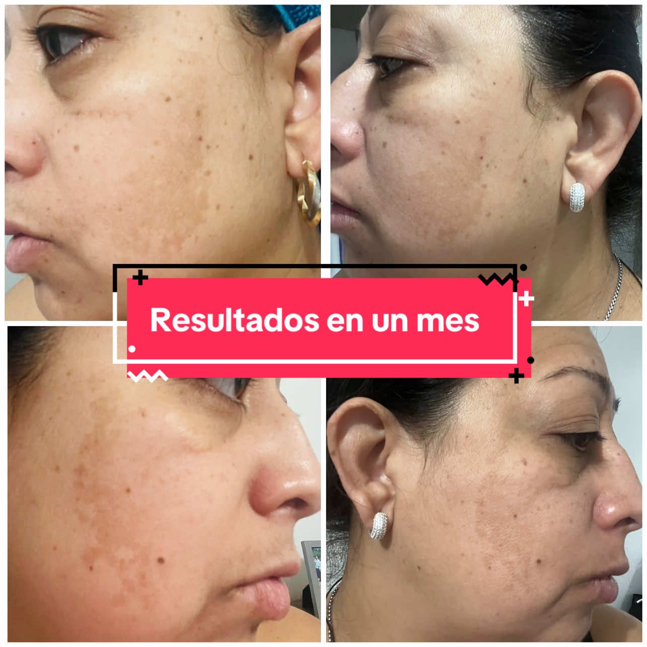 Me frustraba no encontrar algo que me ayudara , hasta que al fin lo encontré hoy en OMNILIFE  y SEY TU HOY te comparto mis resultados 🥰🥰  🔗 https://wa.link/c1hbm7 🔗 https://portal.omnilife.com/client-register?distributor_code=DUS0097667FC&country_code=USA&lang= #resultados #seytu #omnilife_seytú #omnilife #foryouchallenge #cambios #reelss #paratiii #comenta 