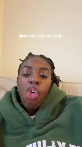 lol I hit my lip when I was little hence the little dangly thing in the middle of my top lip LOOOOL 