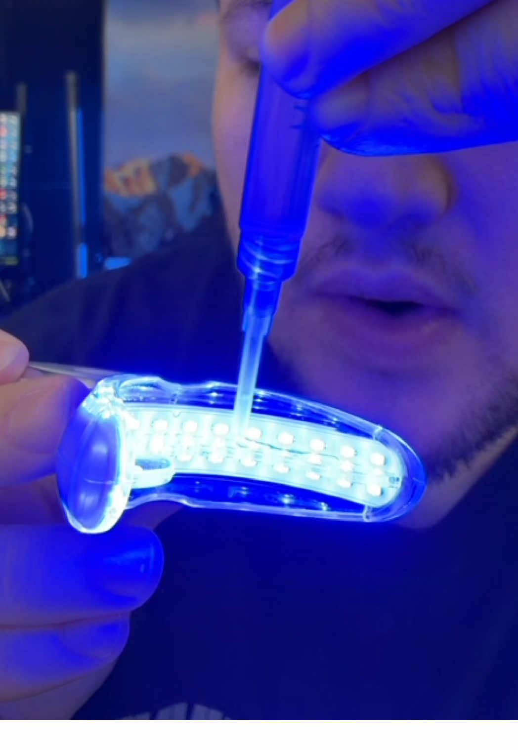 Teeth Whitening Kit you can use while you shower