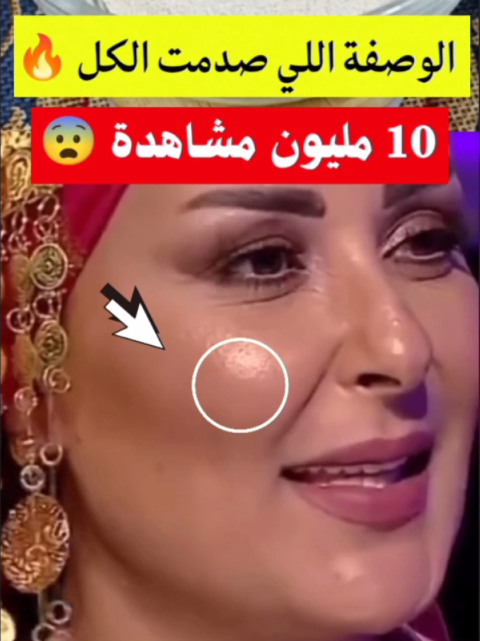 الوصفة اللي صدمت الكل 🔥 10 مليون مشاهدة في أيام#صحتي_بالعربي #صحتي #fyp #viral #علاج 