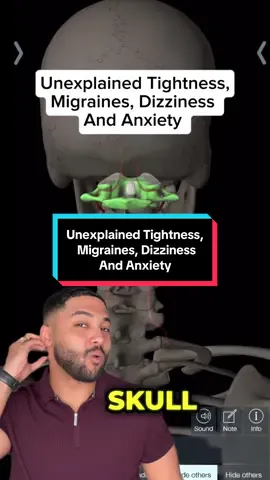 Unexplained neck tightness linked to unusual neurological symptoms?  ##fyp##uppercervical##migraines##vertigo##anxiety