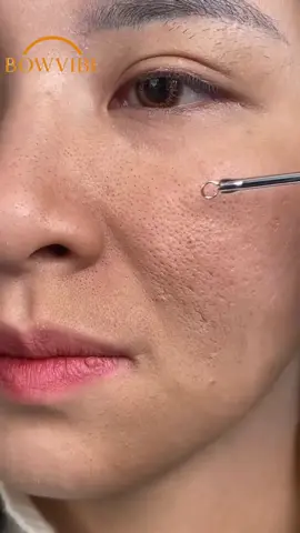 Ce gel exfoliant à l’orange élimine les cellules mortes, nettoie les pores en profondeur et fait disparaître les taches sombres tout en douceur. Grâce à sa formule à base de vitamine C, AHA et niacinamide, il réveille l’éclat naturel de ta peau dès la première utilisation.