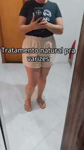 Tratamento pra varizes #varizes #saude #vascular #viraltiktok #veias 
