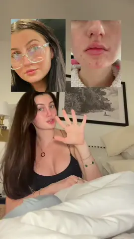 Say goodbye to hard water, hello to softer skin 🚿 #skincareessentials #jolieshowerhead 