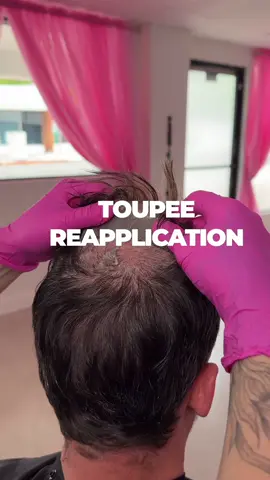 Some people were asking to see a little more about reapplications! #toupee #hair #bald #hairsystem #sandiego          