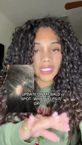 Hair growth. What helps me grow my hair? Coming from a girl who lost quite a bit a while ago. #hairgrowth #hairgrowthtips #hair #tiktokshopblackfriday #tiktokshopcybermonday 