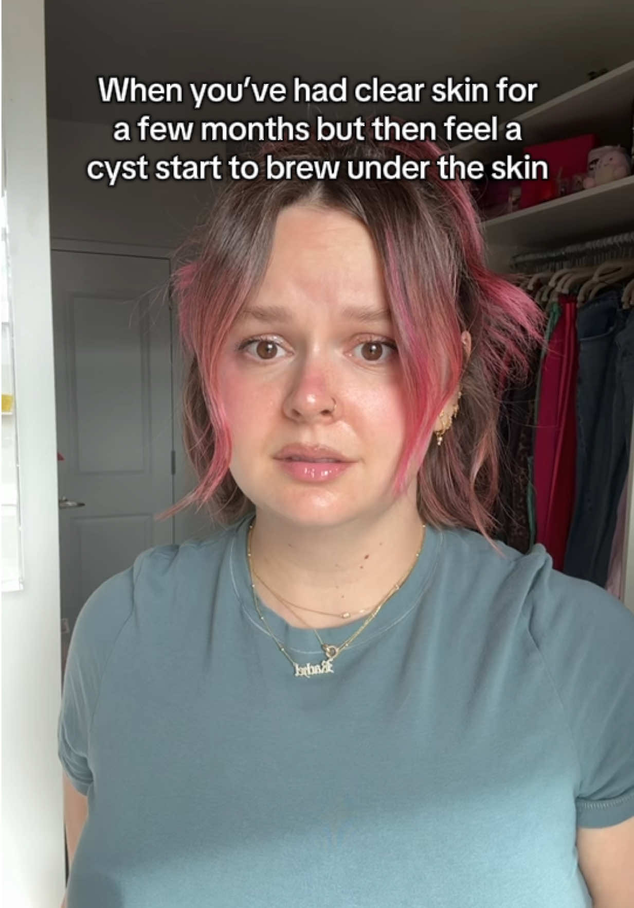 The anxietyyyyy I feel when a big ol’ cyst is brewing 🥺 #acne 