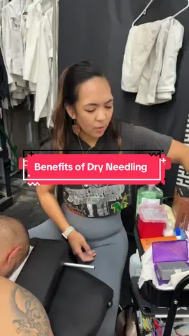 I Had my 1st session of dry needling. I liked it. #mma #martialarts #muaythai #jiujitsu #brazilianjiujitsu 