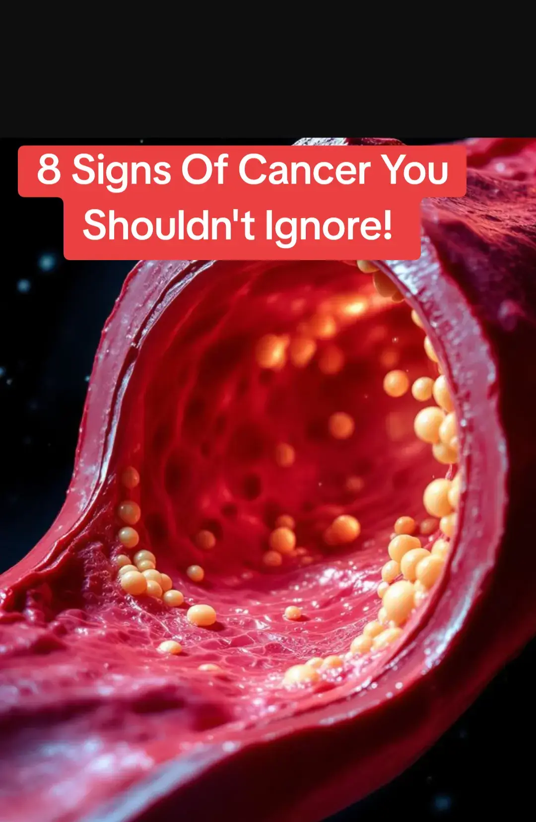 #healthtips #cancer #cancerawarness #cancerfighter #canciones 