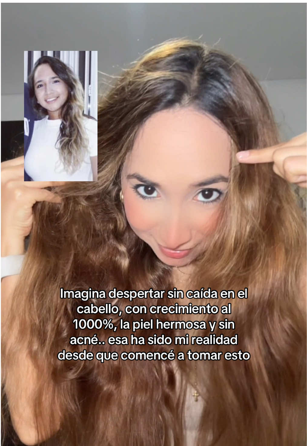 Si esto es un sueño no me despierten 😮‍💨😮‍💨  #hair #hairgrowth #hairtransformation #usa_tiktok #tiktokshopblackfriday 