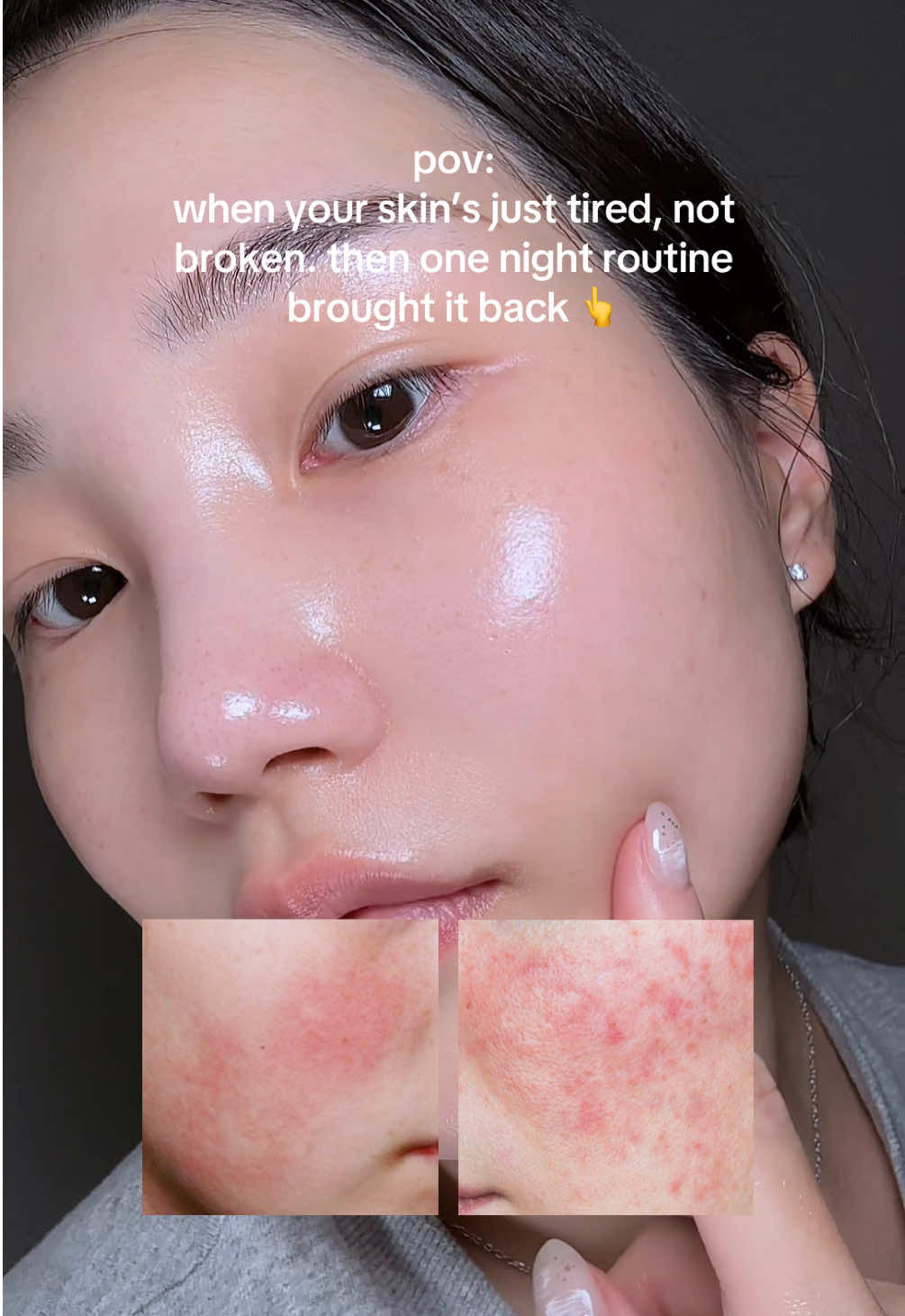 just pressed my skin reset mode tonight 🍵  products: @bringgreen_official ZINC TECA Blemish Serum  @celimax.global Noni Energy Ampoule @Centellian24 Madeca Gel Serum Hyalron Dew #skincareroutine #koreanskincare #kbeautytiktok #skincarehacks #sensitiveskinfriendly 