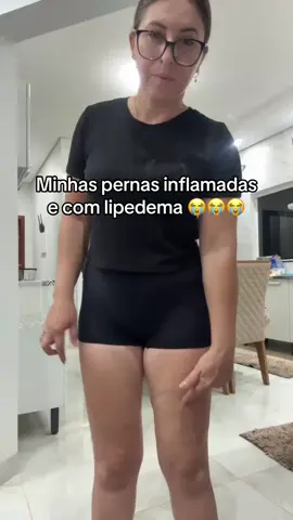 Enfim, acabando com lipedema das minhas pernas #lipedema #cremerosa #celulite #mulher #brasil🇧🇷 