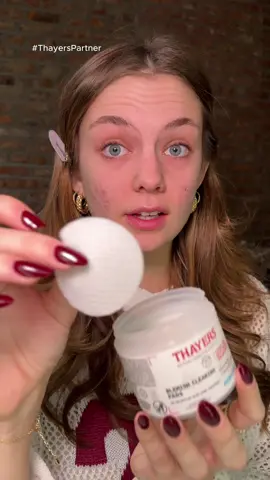 luxury skincare for $10?? count me in😋 @Thayers #ThayersPartner #fyp #acnescars #acneprone #acneskincare 